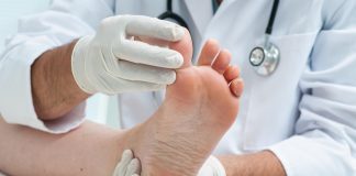 How to Identify Fungal Nail Infections ATHLETE'S FOOT
