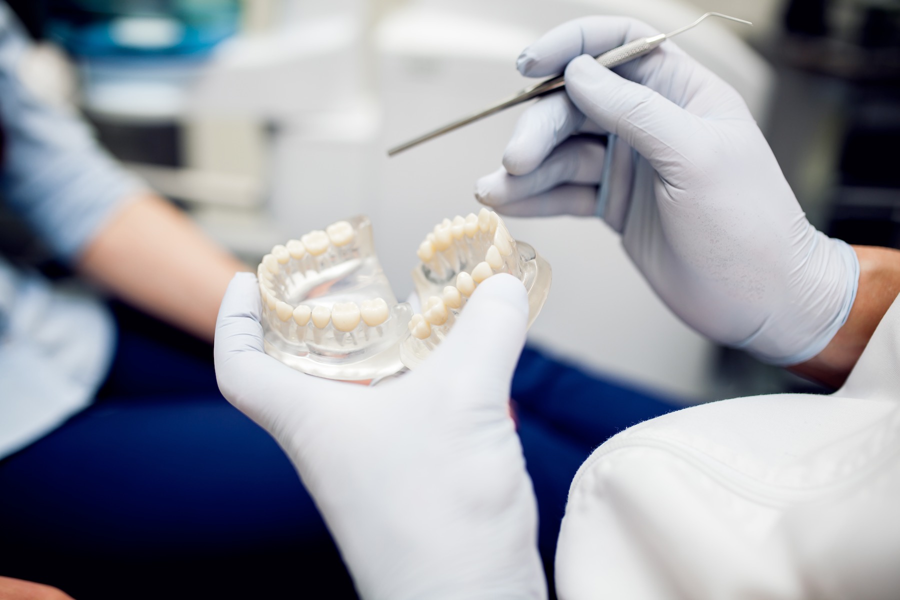 All You Should Know About Dental Crowns