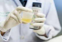 4 Top Foods to Avoid Before a Urine Drug Test