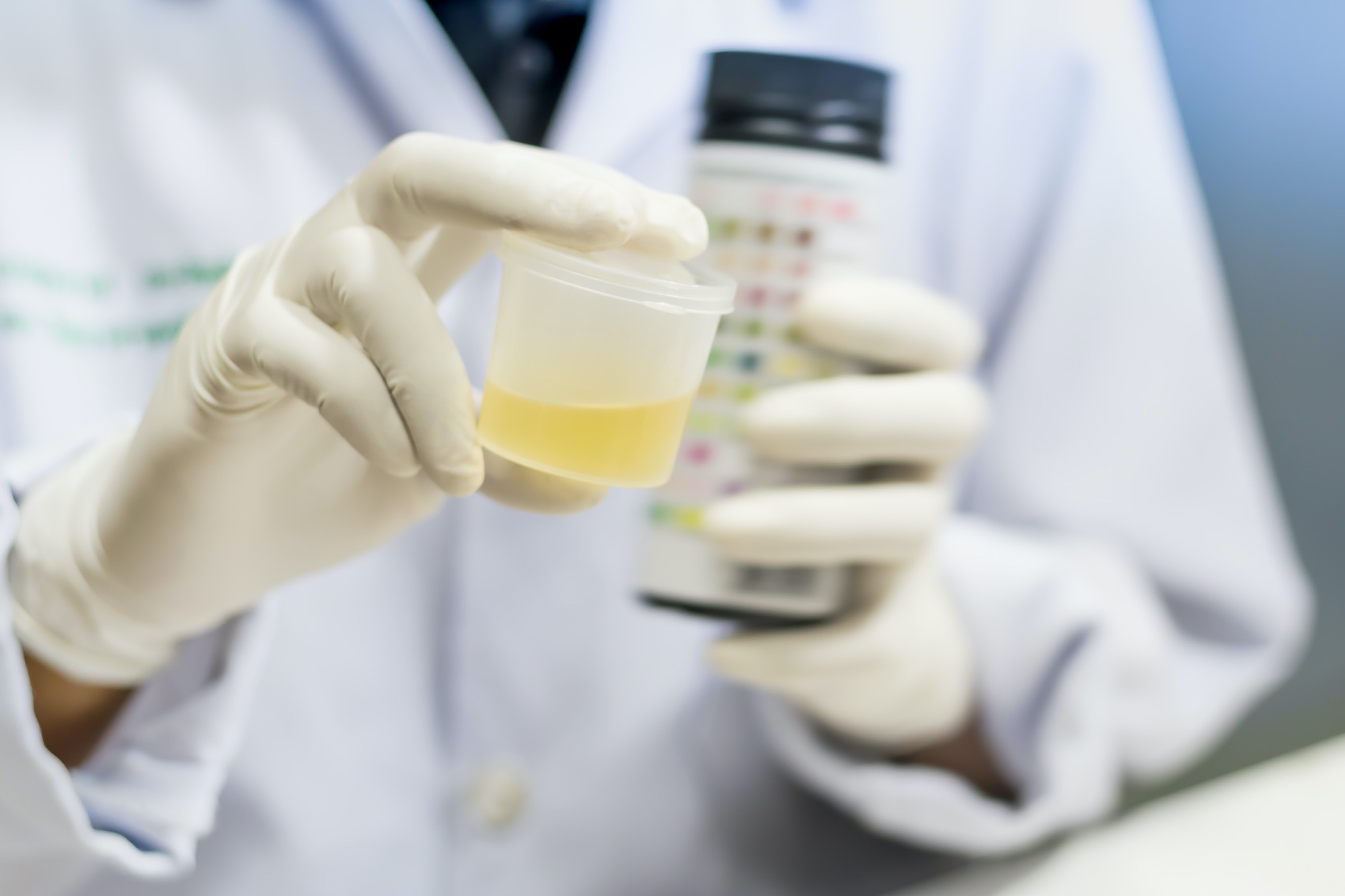 4 Top Foods to Avoid Before a Urine Drug Test