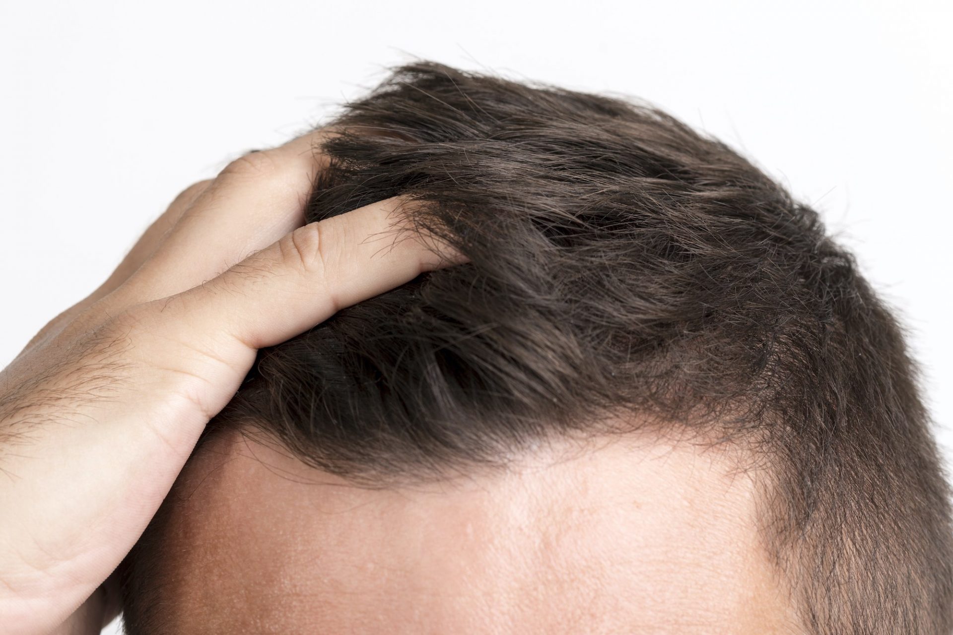 how long does it take for hair to grow back how long does it take for hair to grow back