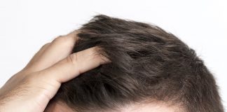 Is Hair Transplantation Suitable for Everyone – Zty Hair Transplant Turkey Hair