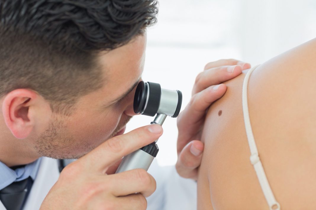 A Comprehensive Guide on How to Prevent Skin Cancer