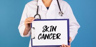 Debunking the Common Basal Cell Carcinoma Myths Skin Cancer