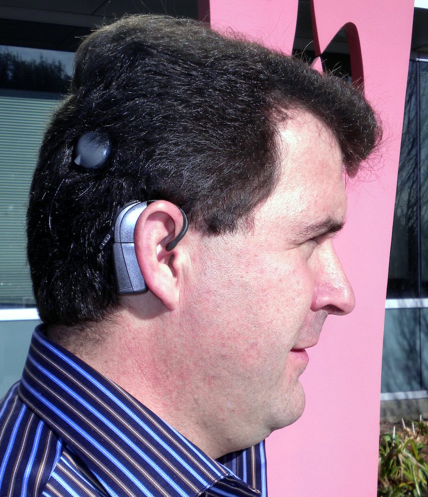 Cochlear Implants