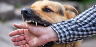 7 Tips for Identifying a Good Dog Bite Lawyer