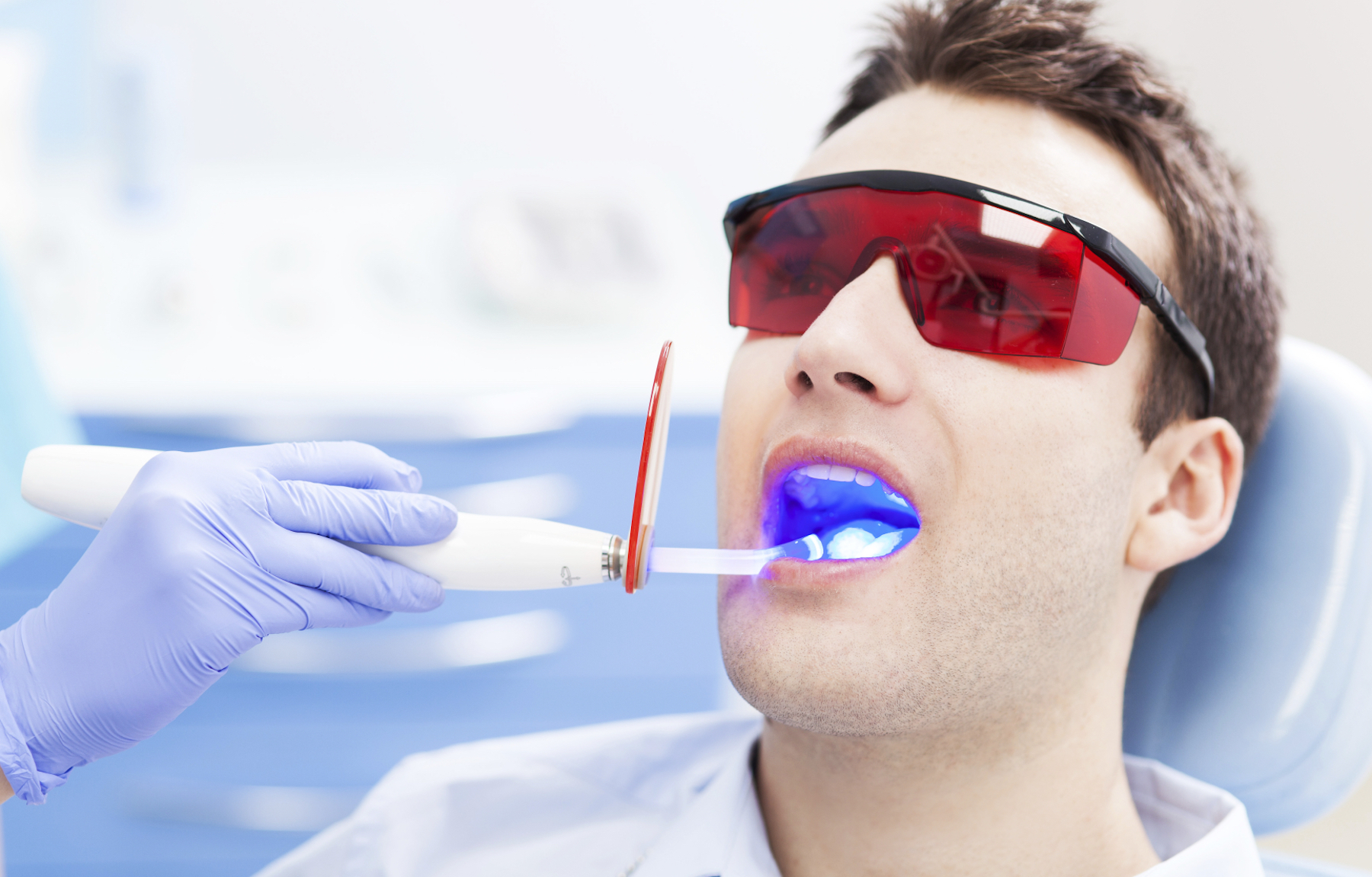 Laser-Teeth-Whitening