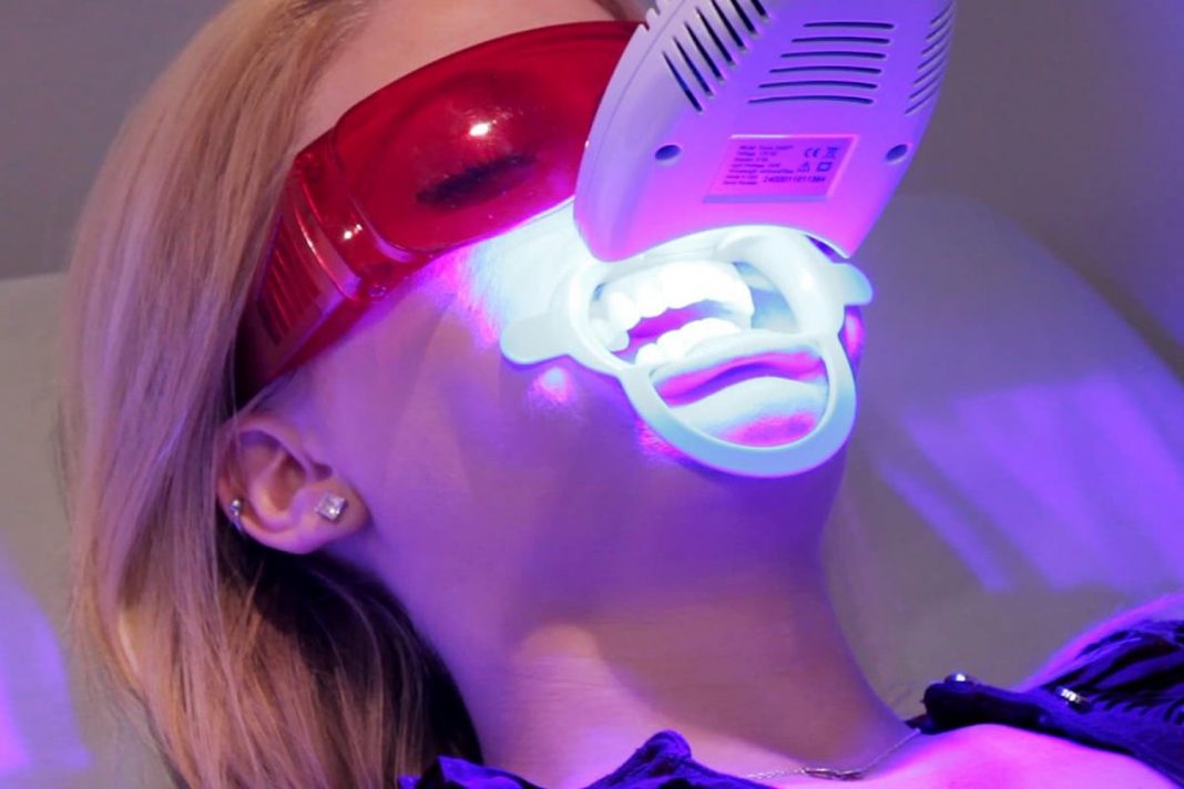 laser whitening