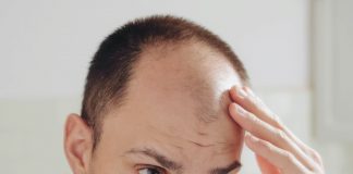 How Much Can You Expect To Pay For Scalp Micropigmentation bald