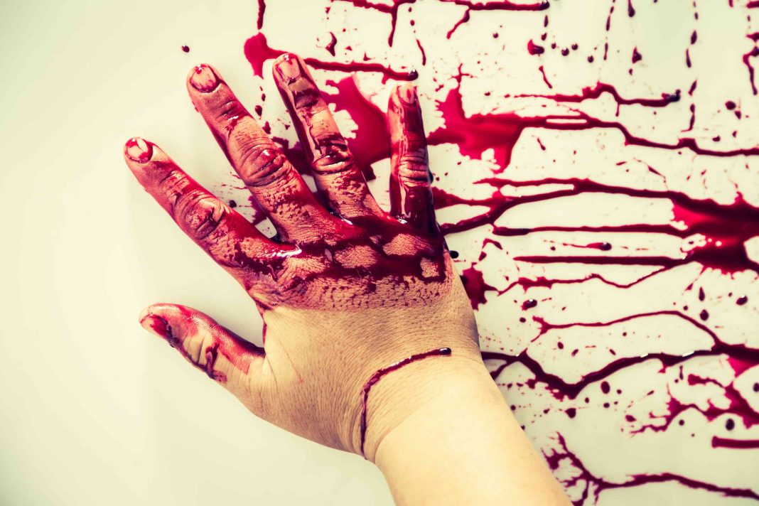 Halloween concept : Hand in blood ( Filtered image processed vintage effect. ) Understanding Delgloving Injuries in Men