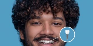 Essential Guide to Dental Implant Maintenance: Ensuring a Lasting Smile Guide to Dental Implant Maintenance